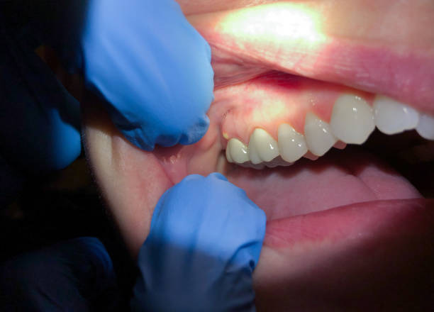 Best Emergency Denture Repair in Wichita Falls, TX